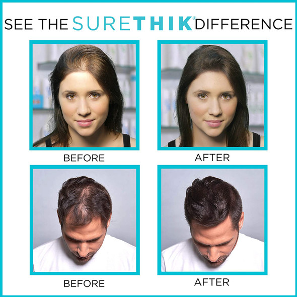 SURETHIK Hair Thickening Fibers for Thicker Looking Hair, Dark Brown, 30g