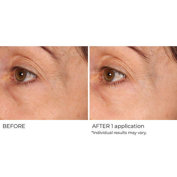 NASSIFMD Wrinkle Blur Targeted Treatment