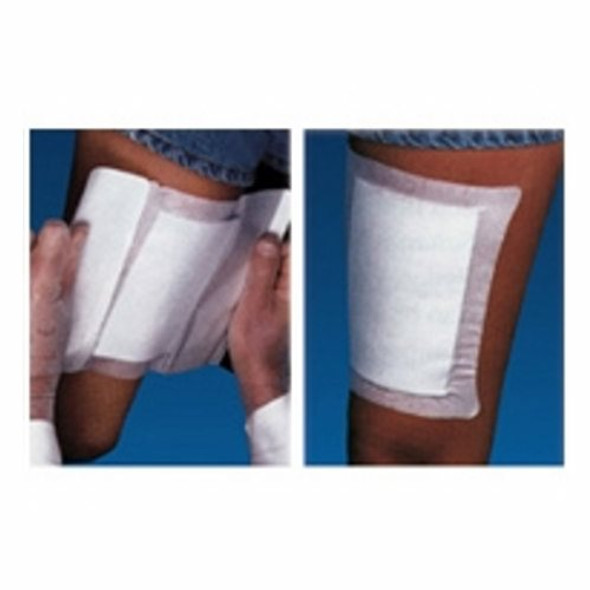 Adhesive Dressing WoundGard 6 X 6 Inch Gauze Square White Sterile 30 Count By MPM Medical