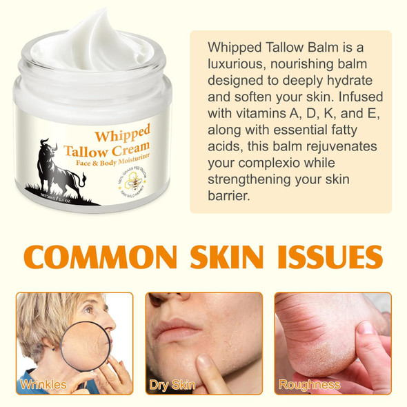 Beef Tallow For Skin, Beef Tallow, Organic Grass Fed Beef Tallow - Tallow And Honey Balm- Deeply Moisturizing, All-Natural Handmade Lotion Whipped Beef Tallow Face Moisturizer
