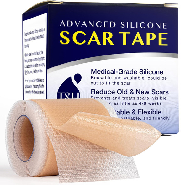 Advanced Silicone Scar Sheets Tape - Medical Grade Soft Silicone Gel Scar Sheets Tape, Highly Comfortable Painless For C-Section, Stretch Marks, Acne, Surgery, Effective Scars Treatment Tapes