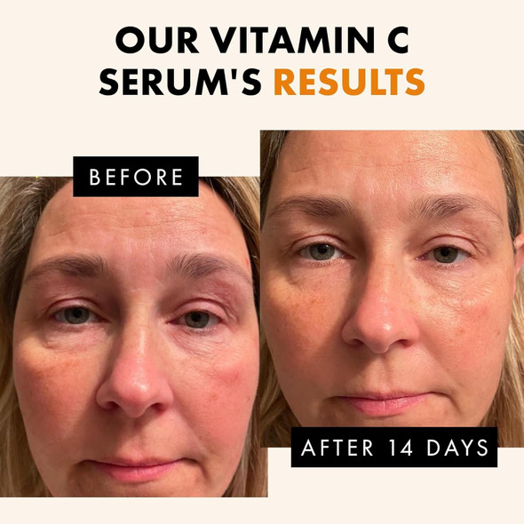 Eclat Skincare Vitamin C Face Serum - Skin Care For Dark Spots Vitamin C Serum With Hyaluronic Acid Ferulic Acid & Vit E - Anti Aging And Skin Brightening Pure Vit C Facial Care - 30 Ml