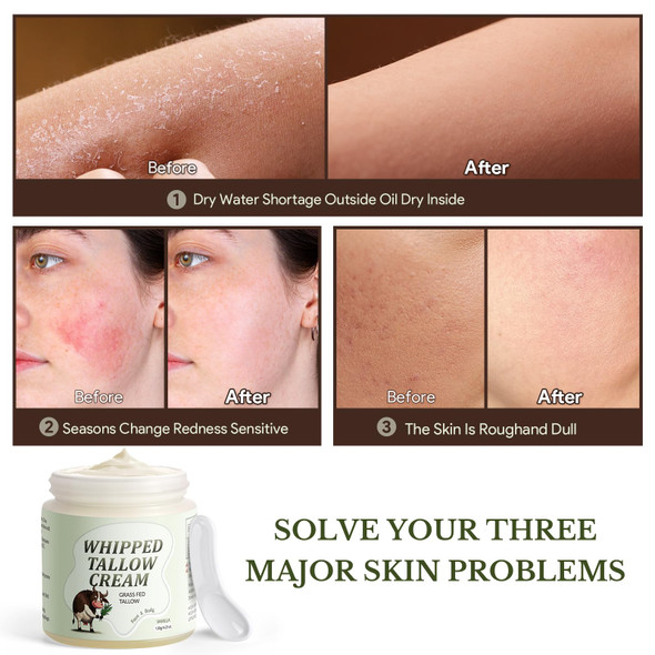 Ingbear Beef Tallow Skin Care Whipped Tallow Face Cream Beef Tallow Moisturiser for Face & Body Natural Grass Fed Beef Tallow Skin Care Cream for Dry Skin Vanillin 120g