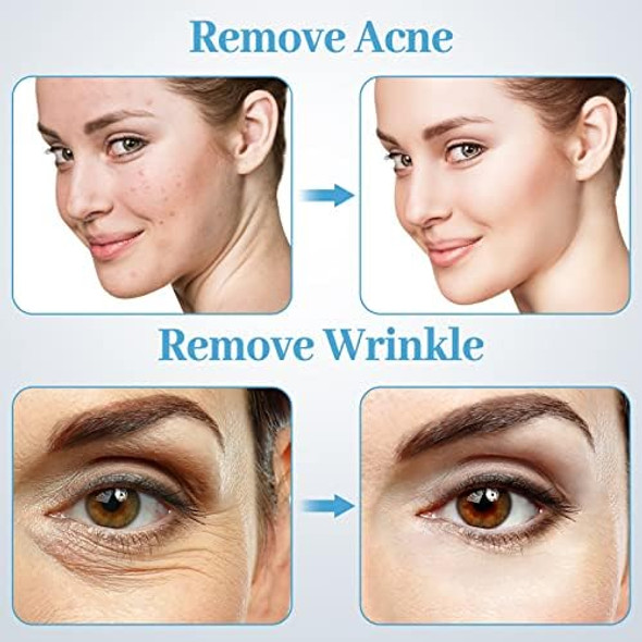 Mcwdoit Microderm Machine With Spray Gun Mcwdoit Professional Facial Skin Care Beauty Device Home Salon (Suction Power: 0-68Cmhg)