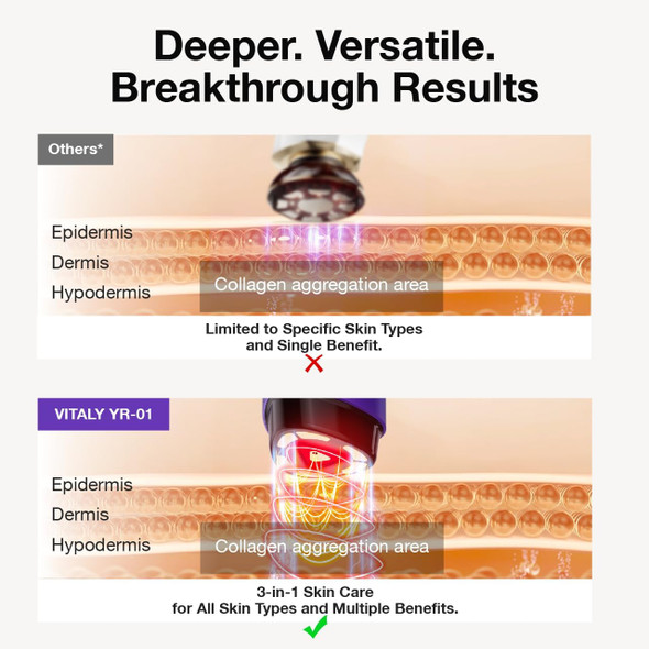 Vitaly Skin Tightening Face Machine Facial Massager Light Therapy For Face 3 In 1 Microcurrent Facial Device Home Use Anti-Aging Device 5 Level For Facial Firming Wrinkle