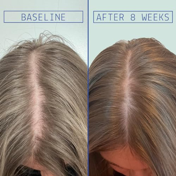 Aavrani Hair Density Boosting Treatment - Ashwagandha, Vegan Collagen, And Turmeric Scalp Serum For Thicker, Fuller Hair - Vegan, Non-Greasy - 2 Fl Oz