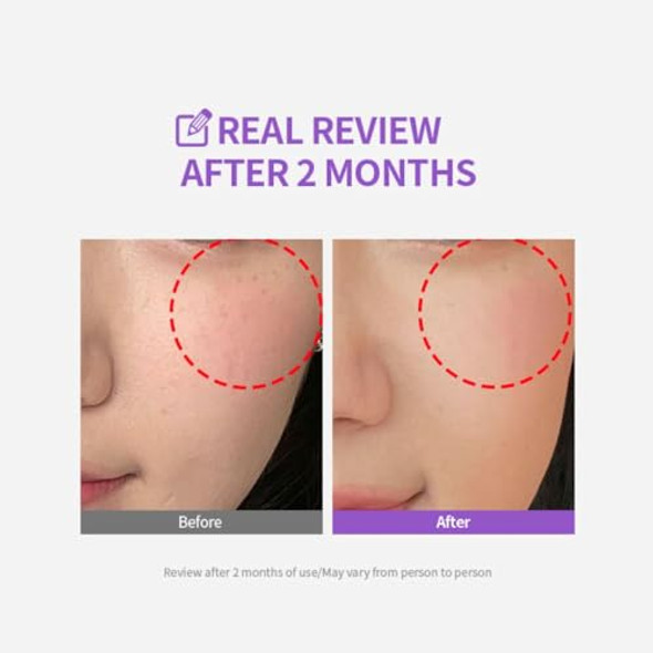 Sungboon Editor Meoru Podo Vita C Brightening Cream  Facial Moisturizer For Brightening, Correcting Blemishes, Soothing  Vitamin C, Niacinamide, Hyaluronic Acid, Cica  Korean Skincare