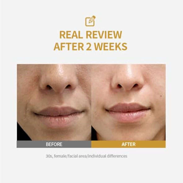 Sungboon Editor Silk Peptide Intensive Lifting Ampoule  Instant Fine Lines Smoothing & Skin Tightening & Firming Facial Ampoule Serum  Korean Skincare