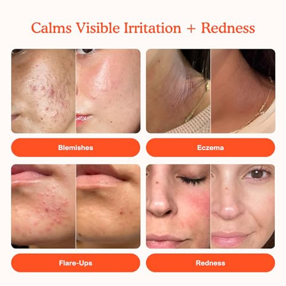 Tower 28 Sos Daily Rescue Facial Spray 4 Fl Oz & Tower 28 Sos Intensive Rescue Serum 2 Fl Oz