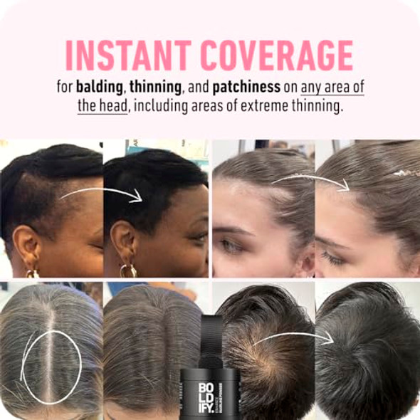 Boldify Hair Fiber + Hairline Powder: Build & Conceal Bundle - Undetectable Hair Thickener For Fine Hair Instant Stain-Proof Root Touchup Powder For Men & Women (Hazel Brown)