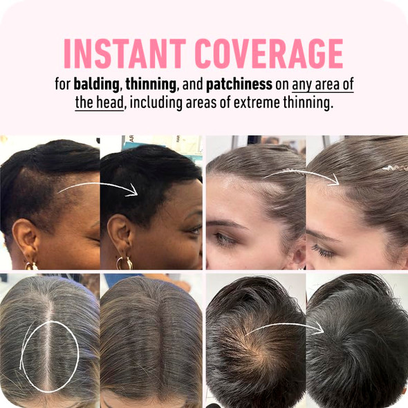 Boldify Hairline Powder + Shampoo + Conditioner: Bundle: Root Touchup Hair Loss Powder And Natural Volumizing Shampoo And Conditioner For Fine Hair (Grey)