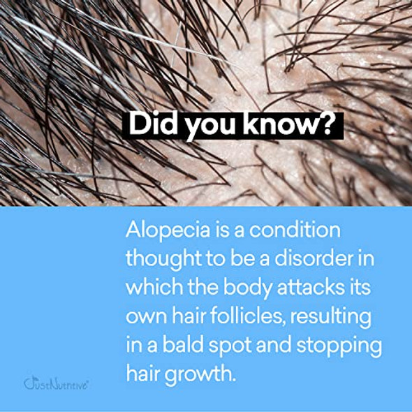 Just Nutritive Alopecia Real Hair Loss Treatment Real Hair & Scalp Therapy Nutritive Ingredients Penetrate To Sooth Just Nutritive 4 Fl Oz