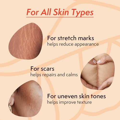 Nature Spell Stretch Mark Oil For Women Vegan Body Oil For Stretch Marks Scars & Uneven Skin Tone 3.38 Fl Oz