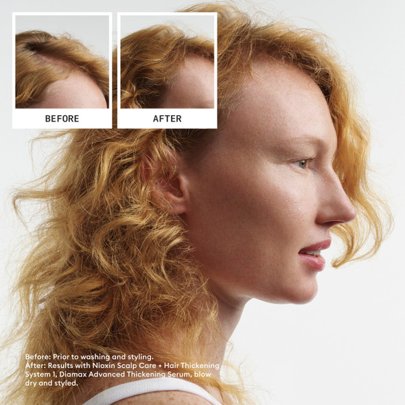 Nioxin System 1 Scalp and  Hair Conditioner Natural Hair with Light Thinning