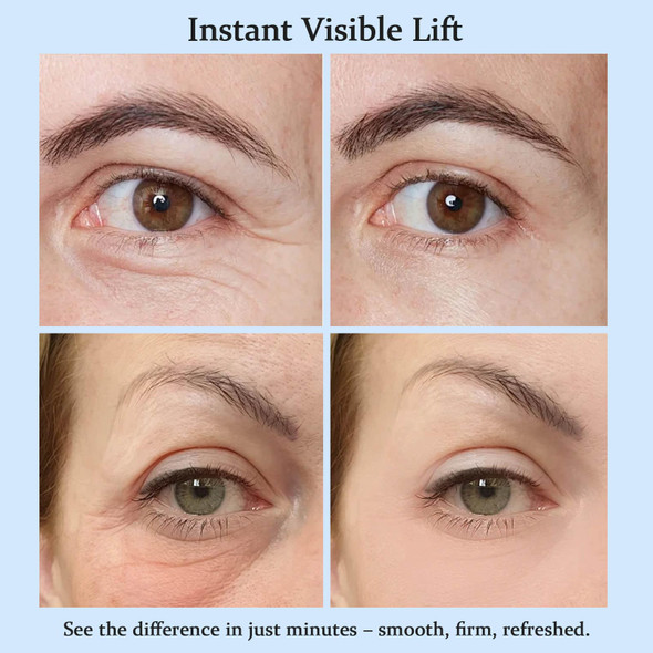 Jinmao Perfection Eye Tightener Ãƒ¢Ã¢Š¬Ã¢‚¬Å“ Instant & Temporary Under Eye Tightener Cream Easy-Wear Formula For Eye Bags & Puffiness 20Ml (2)