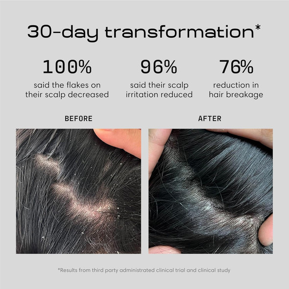 Jupiter Anti Dandruff Shampoo - Shampoo For Men & Women For Flaky Itchy Oily & Dry Scalp - Nourishes Scalp And Reduces Breakage & Flakes - Color-Safe Sulfate- Paraben-