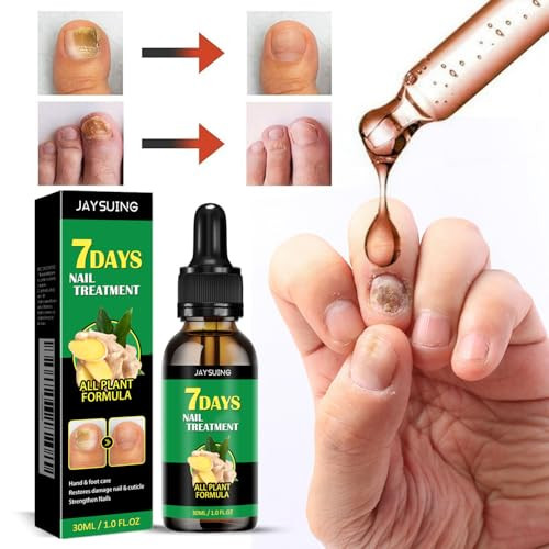 Loyotice 3Pcs Ginger Nail Treatment 7Days Nail Growth Serum Solution Ginger Cuticle Care Oil For Nails Strengthener Promote Nail Healthy Grow(30Ml)
