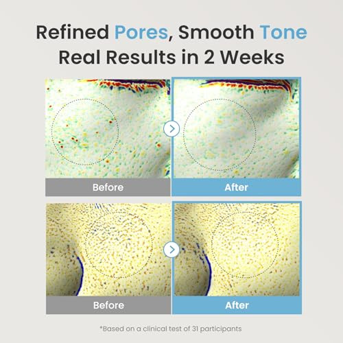 The Face Shop Alltimate Niacinamide 10% Serum For Face With Caffeine & Peptide Korean Skin Care Oil Control & Pores Reducer Improve Skin Elasticity Face Serum For Sensitive Skin Non-Comedogenic