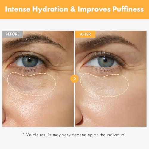 Tosowoong Vita Clinic Vitamin Eye Cream Korean Skincare With 5% Arbutin 2% Niacinamide Hyaluronic Acid Glutathione Seabuckthorn Eye Serum For Fine Lines & Wrinkles Puffiness 15Ml / 0.5 Fl. Oz.