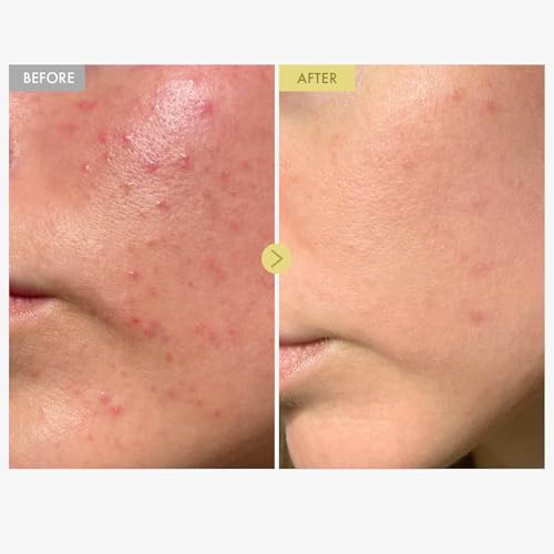 Tosowoong Black Snail Mucin 92% Face Cream 920768Ppm Black Snail Mucin Propolis Lightweight Moisturing Cream For Soft Glowy Skin Moisturizer Face Cream Korean Skin Care 100Ml 3.38 Fl.Oz.