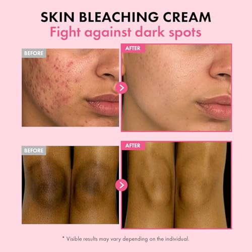 Tosowoong Dark Spot 35 Fade Cream Dark Spot Remover With Arbutin Kojic Acid Niacinamide Skin Bleaching Cream For Face & Body Hyperpigmentation Discoloration Korean Skincare 50Ml / 1.69 Fl. Oz.