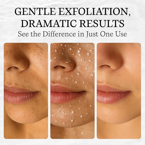 Vivo Per Lei Facial Peeling Gel - Contains Dead Sea Minerals And Nut Shell Powder - Gentle Face Exfoliator Scrub And Blackhead Remover - Peel Your Skin To A Fresher You - 4.05 Fl Oz.