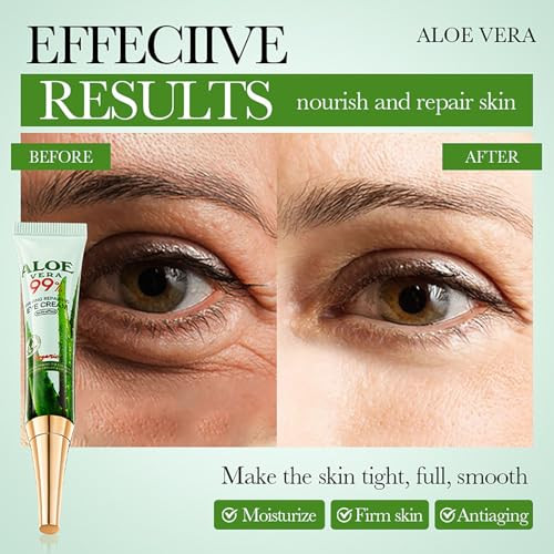Krmspe Under Eye Cream For Dark Circles Anti Aging Eye Cream With Aloe Vera Moisturizer & Tightening For Puffiness & Wrinkles Eye Bags Fine Lines For Men Women All Skin Types (2Pc)
