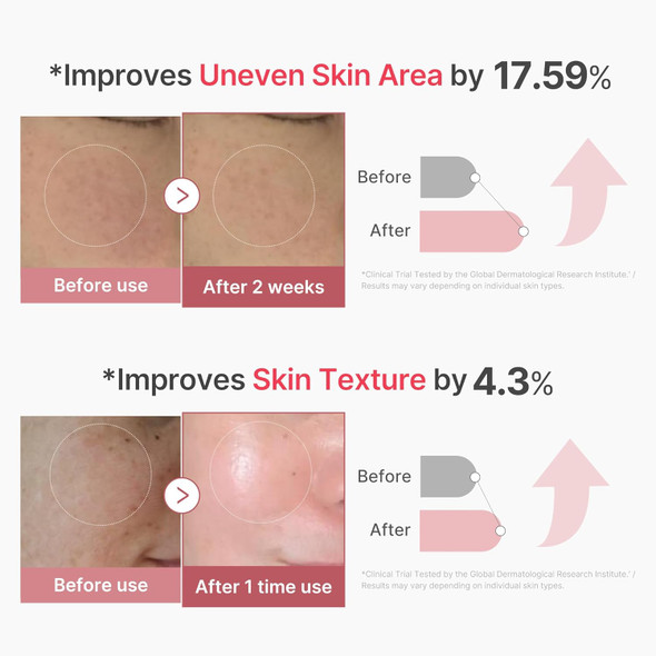 Medicube Zero Exosome Shot 7500 Ppm Spicule Facial Serum Liquid Skin Booster Serum Exosome Aha+Bha+Pha Pore Care Dead Skin Cells Skin Texture Korean Skin Care 1.01 Fl.Oz