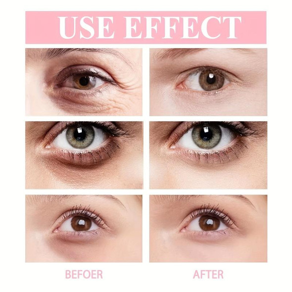 Retinol Eye Cream Stick Nourishing Lift Firming Lighten Dark Circles Eye Bags Remover Fade Fine Lines Hydrating Eye Cream Stick