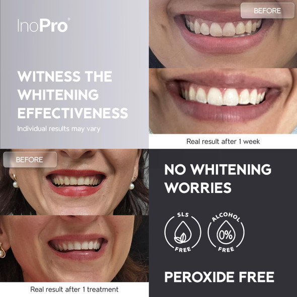 InoPro Natural Teeth Whitening Strips Kit 21 Treatments - Sensitive Teeth Whitener, Peroxide Free with Papain, Bromelain, Coconut Oil, White Strips for Teeth Whitening (42 Strips)