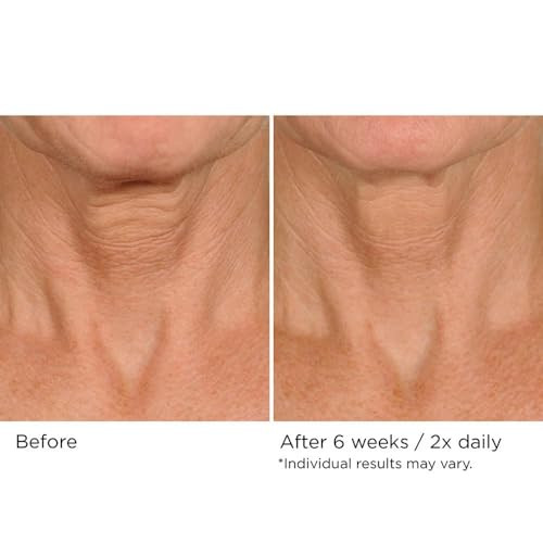 Nassifmd Deco-Lift Neck Firming Complex Serum