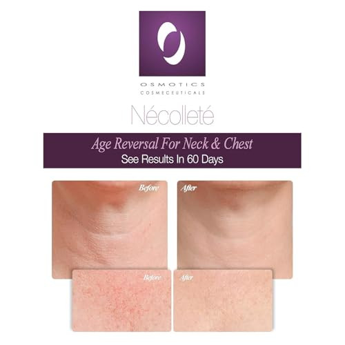 Osmotics Cosmeceuticals Osmotics N Collet Age Reversal For Neck And Chest - Firms Smooths & Tightens Fragile Skin On Neck Chest & D Collet | Anti-Aging Formula For Sun Damage - 1.7Oz