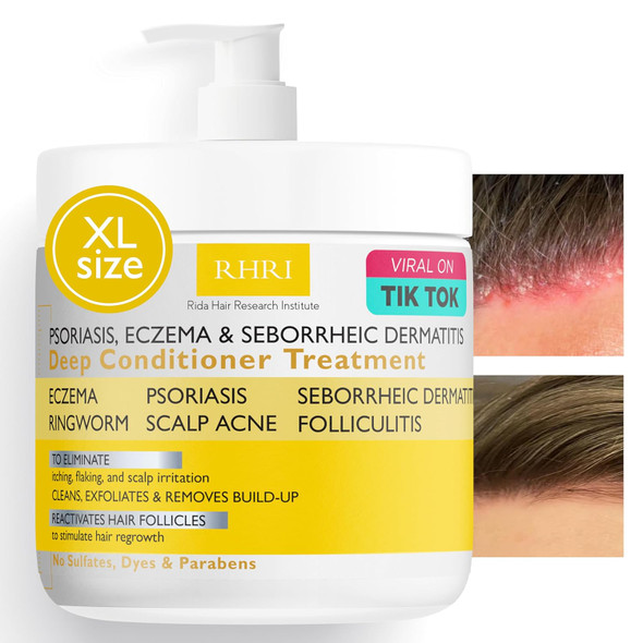 Rida Hair Research Institute Psoriasis Scalp Spray | Psoriasis And Dandruff Treatment For Scalp Yeast Infections Psoriasis Flare-Ups & Folliculitis | Antifungal Ringworm Itchy Scalp Spray For Psoriasis Dryness