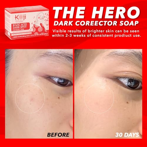 Koji White 4% Kojic Acid Dark Spot Corrector Soap For Sensitive Skin - Moisturizes With Vitamin C Licorice Root Extract Hydrating & Even Tone Cleansing Bar For Face & Body Vegan 3.52 Oz (2 Bars)