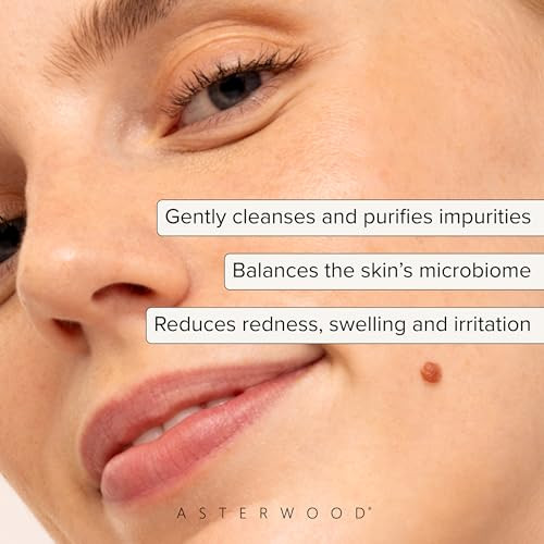 Asterwood Hypochlorous Acid Spray For Face - Targets Acne Redness Irritation - Multi-Purpose Skin Repair - Antibacterial Antimicrobial - After Gym/Post-Workout Facial Mist 4 Fl Oz