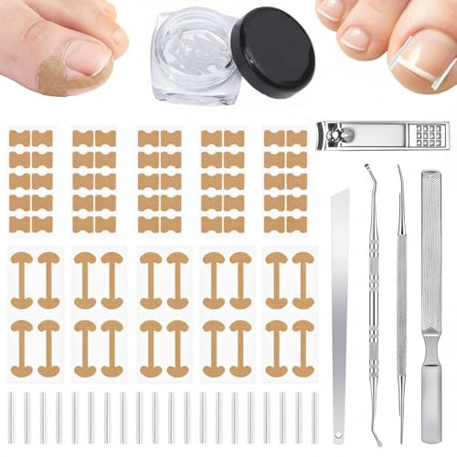 Callmynm Ingrown Toenail Corrector Set Professional Ingrown Nail Treatment Kit With Breathable Correction Strips Curved Patches And Complete Pedicure Tool Set For Pain Relief And Healthy Nail Growth