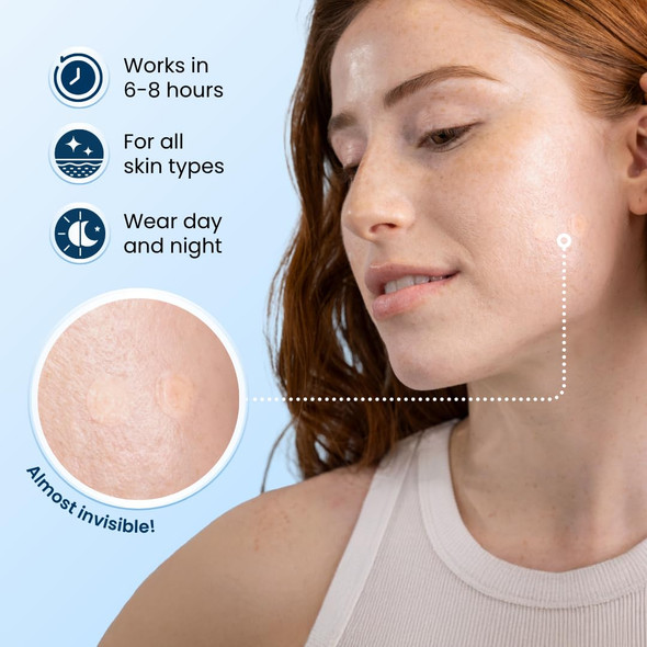 Clean Skin Club 60 Invisible Vegan Pimple Patches Derma Dot Hydrocolloid For Covering Zits Blackhead Blemish Absorbing Face Cover Sticker Skincare Treatment Non Toxic Ingredients