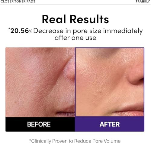 Frankly Pore Closer Toner Pads L Rice Jelly Pads With 9 Peptides Vegan Collagen Rice Extract L Pore Minimizer L Hydrating For All Skin Types L Korean Skin Care 70 Count