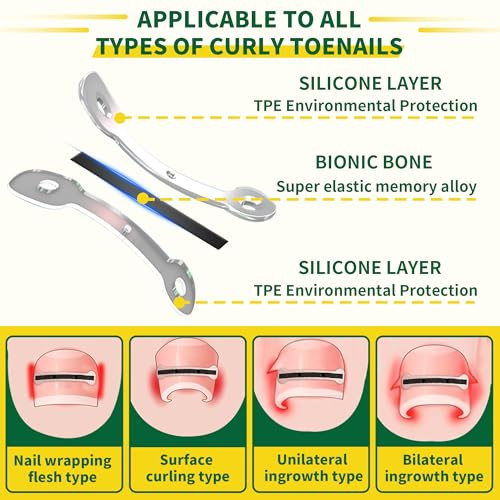 Fuzzycare Large Size-Titanium Alloy Ingrown Toenail Treatment & Removal Kit For Quick Relief Ingrown Toenail Removal Kit Professional Ingrown Toenail Corrector Ingrown Toenail Tools For Quick Relief 10 Pcs