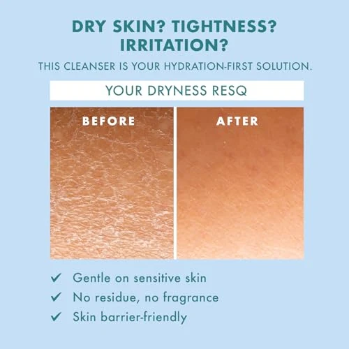 Skin Resq By Petal Fresh Hello Hydration Cleanser Daily Gentle Foaming Facial Cleanser With 2% Squalane Complex And Aloe Vera Fragrance Hydrating Face Wash For Dry Sensitive Skin 10 Oz