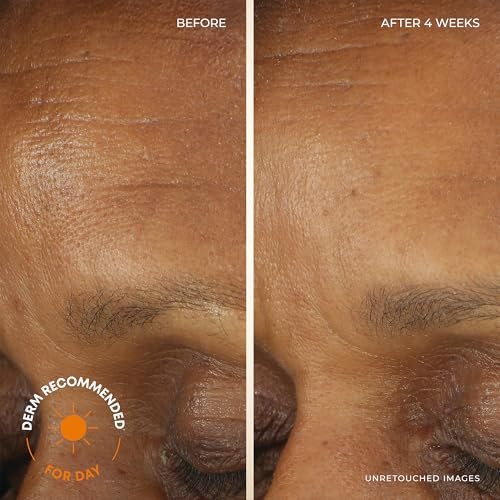 Roc Retinol Correxion Deep Wrinkle Facial Moisturizer Skin Care Bundle: Retinol Correxion Deep Wrinkle Night Cream + Deep Wrinkle Day Cream With Spf 30