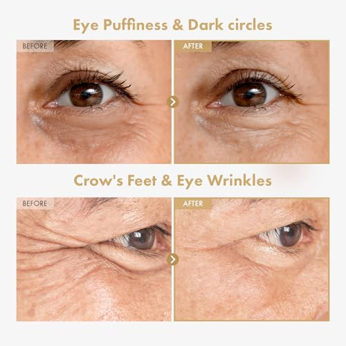 Tosowoong Ginseng Plus Retinal Eye Serum With Retinal Niacinamide Bakuchiol Correction For Puffy Eye Bags Fine Lines Dark Circles Wrinkles Korean Skin Care 30Ml 1.01 Fl.Oz