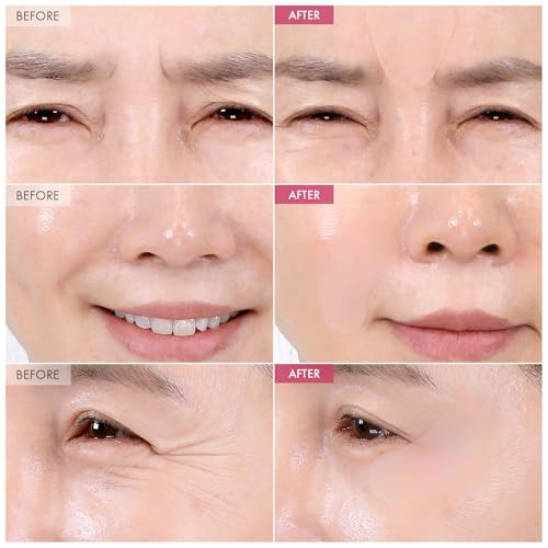 Tosowoong Anti-Wrinkle Patch With Hydrolyzed Collagen Forehead & Eye & Smile Line Wrinkle Patches Anti-Wrinkle Tape K-Beauty Overnight Under Eye Patches Korean Skincare 5Ea (10Patches X 5)