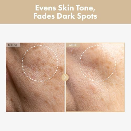 Tosowoong Rice Glow Milky Toner With 784000Ppm Korean Rice Water Niacinamide Ceramides Panthenol Glow Glass Skin Hydrating Purifying Fragrance- Korean Skin Care 250Ml 8.45 Fl.Oz