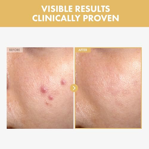 Tosowoong Black Snail Ginseng Serum Ginseng 640430Ppm Snail Mucin Hydrating Facial Moisturizer Acne Scar Remover Self Care Glow Skin Under Makeup Korean Skin Care 30Ml 1.01 Fl. Oz