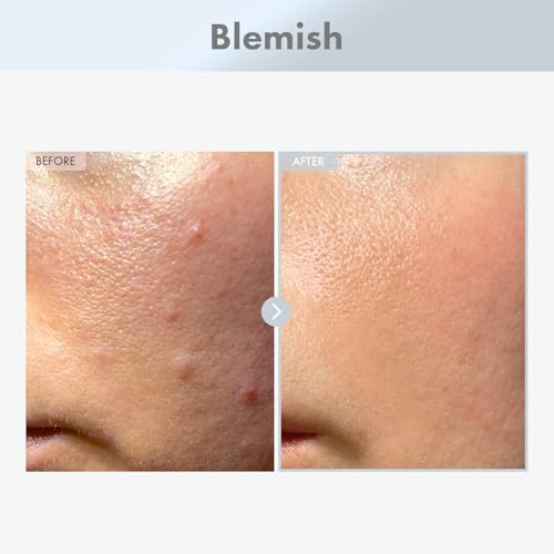 Tosowoong Niacinamide 15% Face Serum 150100Ppm Niacinamide Tranexamic Acid Dark Spot Corrector Glass Skin Radiant Complexion Pore Minimizer Even Skin Tone Korean Skin Care 30Ml 1.01 Fl.Oz