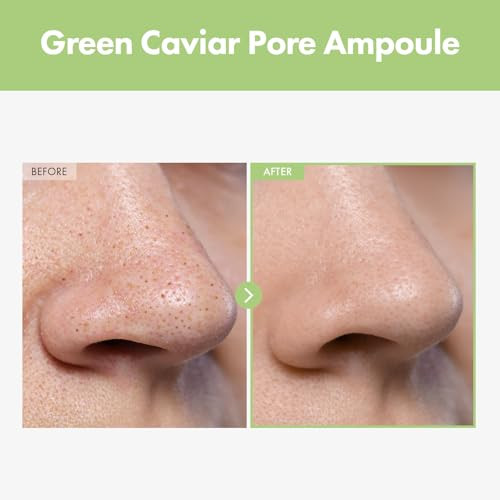 Tosowoong Green Caviar Pore Ampoule With 2500Ppm Green Caviar Niacinamide Pore Minimizer Hydrating Firming Pore Tightening Reduces Pores Korean Skin Care 33Ml 1.11 Fl.Oz