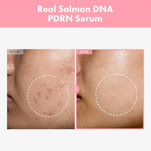 Tosowoong Pink Peptide 12 Pdrn Serum With Salmon Dna Pdrn 10320Ppm 12 Peptides Niacinamide Skin Glow Hydrating Moisturizing Firming Uneven Skin Tone Korean Skincare 33Ml 1.11 Fl.Oz