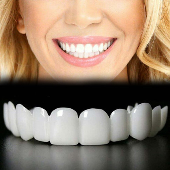 Sunnydeer Temporary Adjustable Smile Support - 2 Pairs Comfortable & Secure Top & Bottom Included (1)