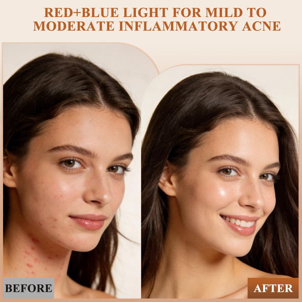 Aimilove Led Light Therapy Mask For Face And Neck, Cordless & Rechargeable, Infrared,Red & Blue Light For Wrinkles And Acne Care, Full Coverage Skincare Device